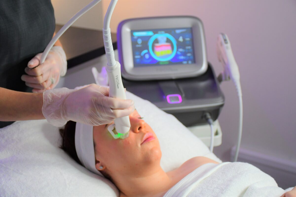 RF Microneedling London