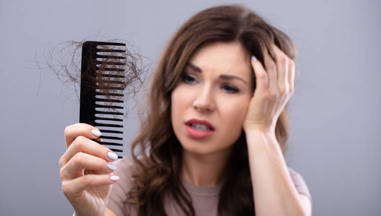 hair loss remedies