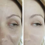 Ceramides for Skin: The Ultimate Guide to Glowing Complexion