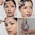 Cosmetic Needling – Euphoria Skin and Wellness