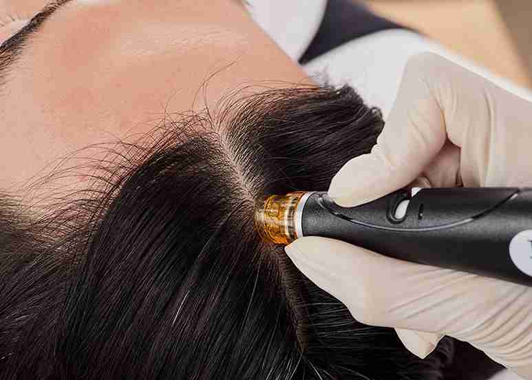 Does Keravive help with Hair Thinning & Hair Loss?
