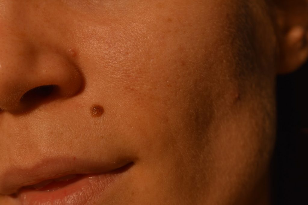 My Biggest Skincare Mistakes – Women’s Concepts